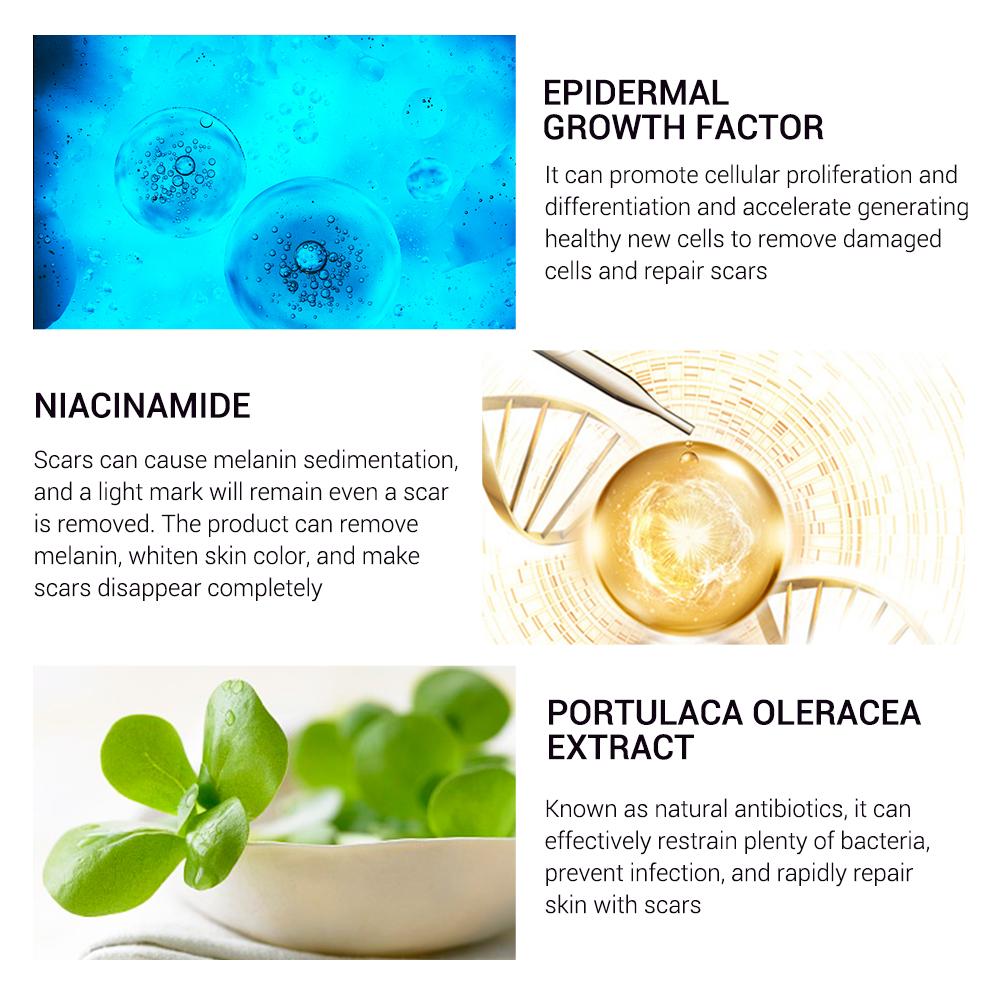 ACNE SCAR REMOVER CREAM