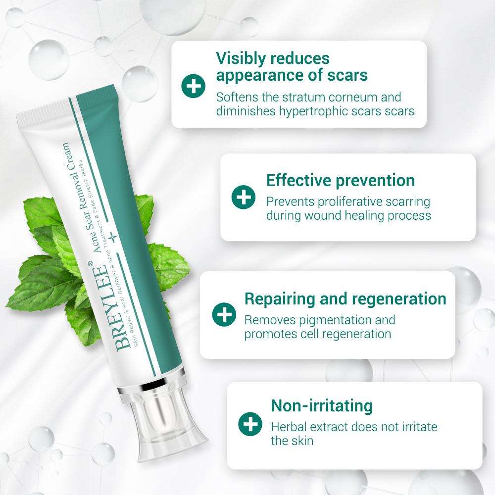 ACNE SCAR REMOVER CREAM