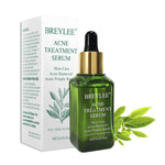 ACNE TREATMENT SERUM